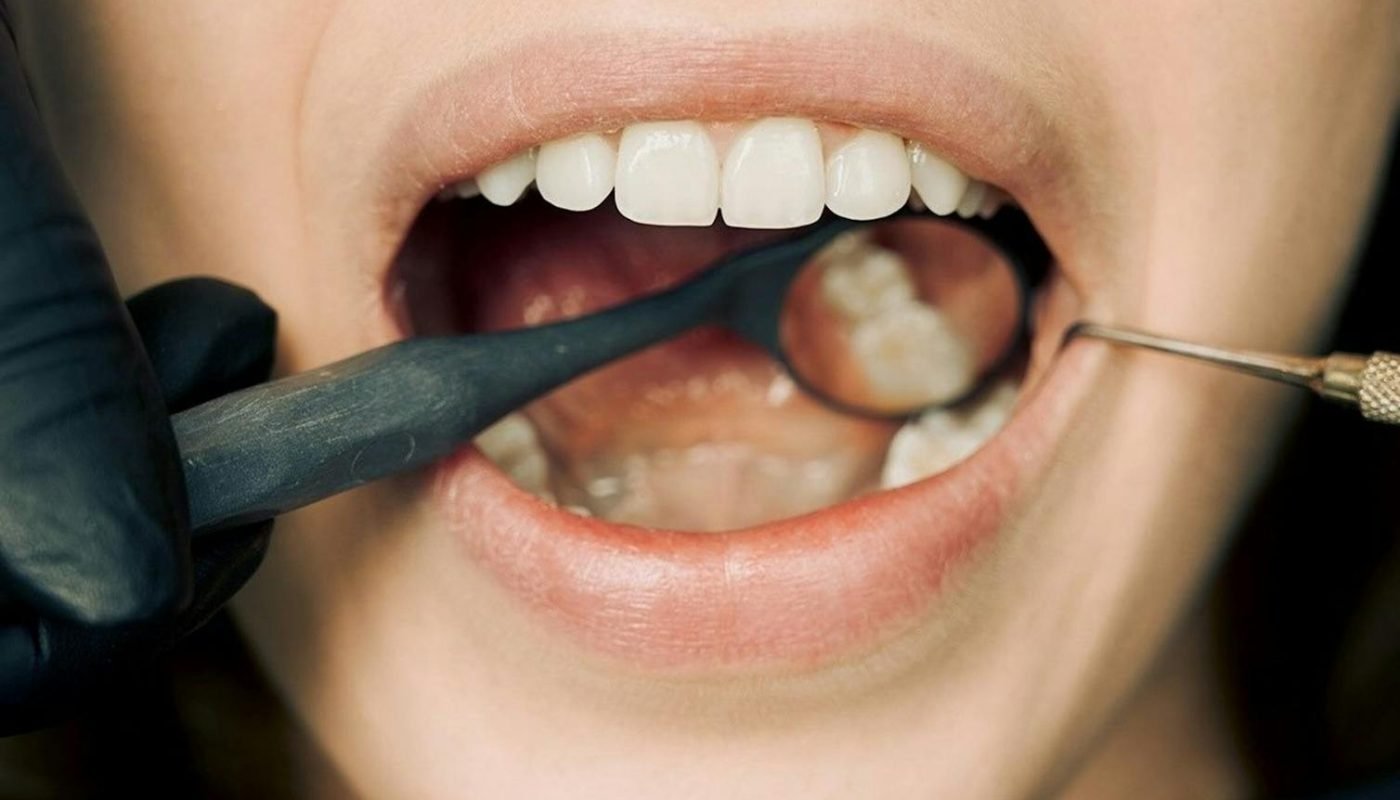 Gros plan d'un examen dentaire avec un équipement moderne, mettant en valeur le maintien de l'hygiène bucco-dentaire.