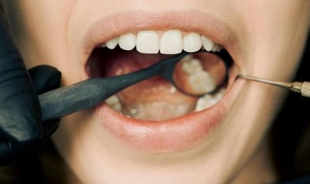 Gros plan d'un examen dentaire avec un équipement moderne, mettant en valeur le maintien de l'hygiène bucco-dentaire.